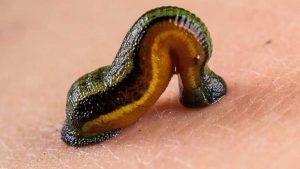 زالو درمانی